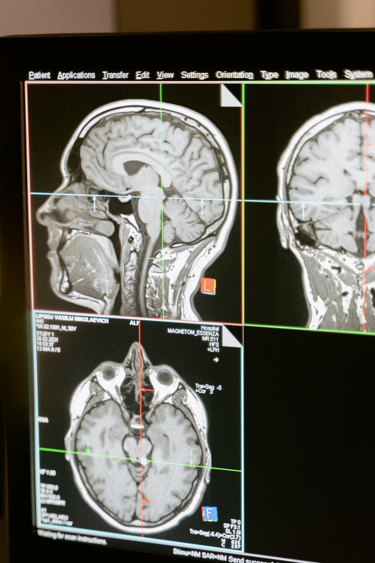 דימות ראש - MRI - פענוח CT ראש