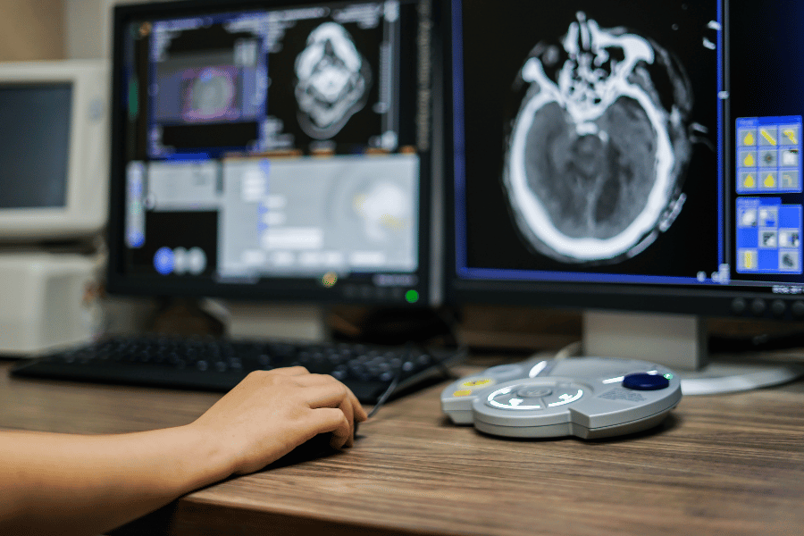 פענוח PET-CT